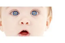 Bebeklerde Katarakt Ameliyatı Sonrası