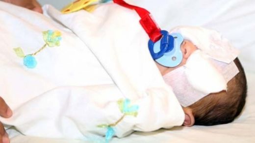 Doğuştan Katarakt Ameliyatı Riskleri ve Sonrası