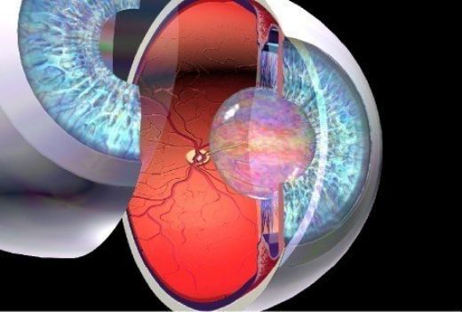 Katarakt Ameliyatı Nasıl Yapılır?